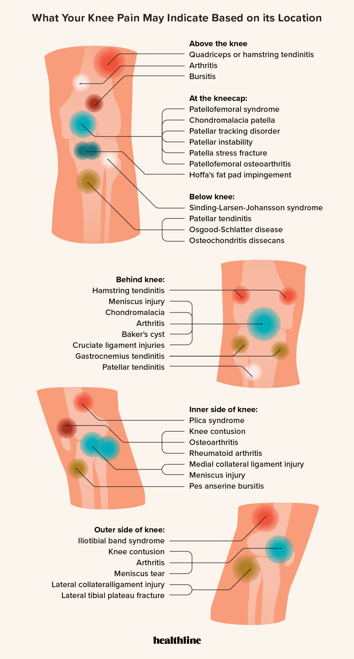 Back Knee Pain Location Chart