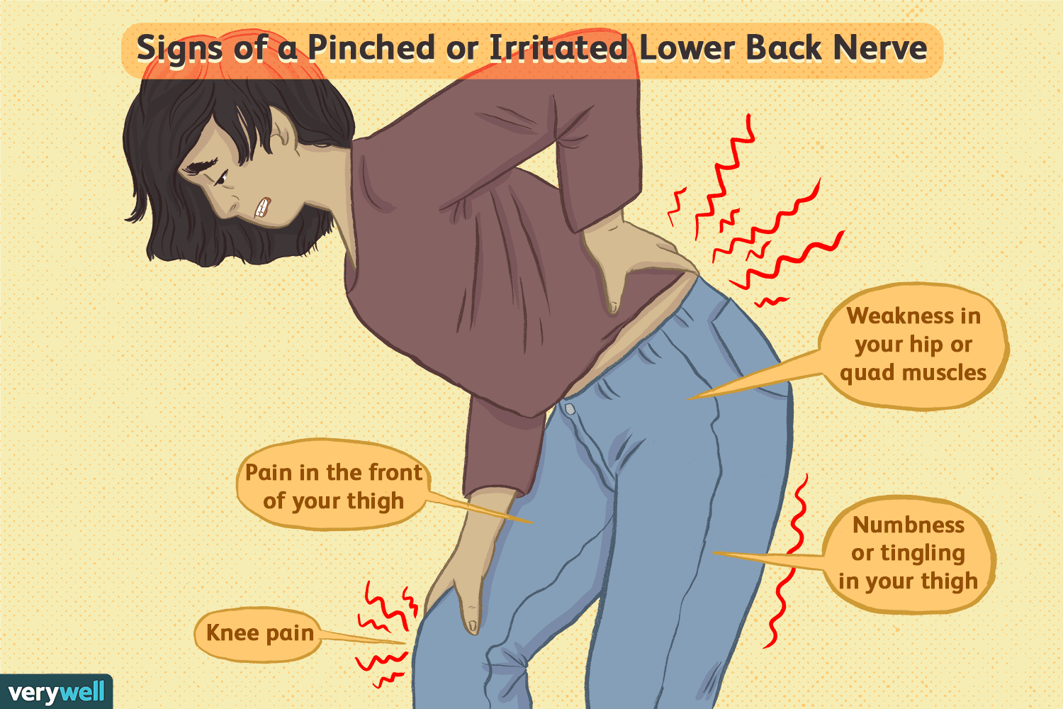 Can Lower Back Pain Cause Knee Pain