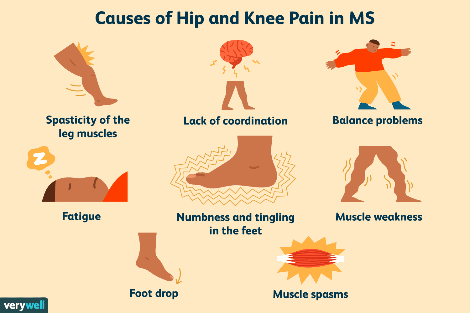 Knee And Hip Pain on One Side